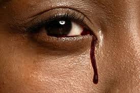 We did not find results for: Pictures Of Unusual Eye Conditions