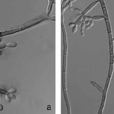 Fonsecaea pedrosoi is a fungal species in the family herpotrichiellaceae, and the major causative agent of chromoblastomycosis. Microscopic Appearance Of Chinese Strains Of Fonsecaea Pedrosoi Left Download Scientific Diagram