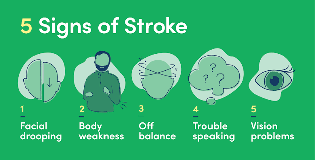 Identify Stroke Symptoms | Signs of Stroke