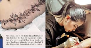 Hello xin chào 500 anh em của băng hải tặc săm soi, chúc anh em 1 ngày tốt lành nhé, chắc hẳn anh em khá là mong chờ góc hỏi đáp số 10 rồi phải không ? Phu Thá»§y 9x NgÆ°á»i Biáº¿n Váº¿t Sáº¹o Má»• Ä'áº» Bá»¥ng Ráº¡n Tung Toe Cá»§a Chá»‹ Em Sau Sinh Thanh Tac Pháº©m Nghá»‡ Thuáº­t Netizen Viá»‡t Giáº£i Tri
