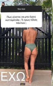 Όταν η κόνι έβαλε χείλη έγινα έξαλλη.τραγικό.το έμαθα από τα social media. H Koni Meta3a Edei3e 3ana Ta Opis8ia Ths Sto Instagram Eikones Sigmalive Magazine