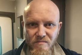 Conor Howard: East Lothian man almost stranded in Corfu after fuel truck  hits his plane