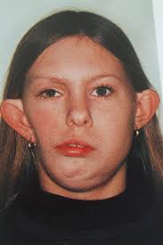 Shelley Hull On What Her Battle With Facial Disfigurement Taught Her About  Beauty