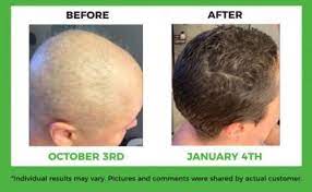 You'll most likely see results after about a month or so, but some people notice a difference in as little as two weeks. Biotin Hair Serum Is Revolutionizing The Hair Care Industry