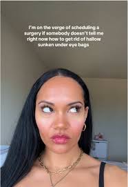 PSA: I'm wearing concealer rn but w/o it my eyes look like a sinkhole ...