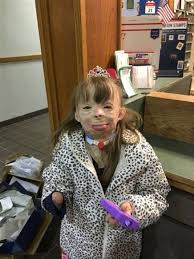 8 Year Old Burn Victim Surprised With A Trip To Disney Christmas Girl Top Gifts For Girls Christmas Card Wishes