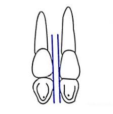 Dental Charting Flashcards Cram Com