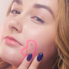 We did not find results for: How To Treat Acne According To A Dermatologist Racked