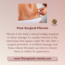 Post Surgical Fibrosis After Plastic Surgery Massage Massage Therapy Scar Tissue