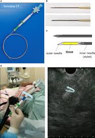 Check spelling or type a new query. Utility Of A 21 Gauge Menghini Type Biopsy Needle With The Rolling Method For An Endoscopic Ultrasound Guided Histological Diagnosis Of Autoimmune Pancreatitis A Retrospective Study Bmc Gastroenterology Full Text