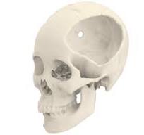Cranioplasty solution