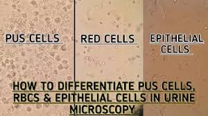 Microscopic Examination Of Urine | Ppt
