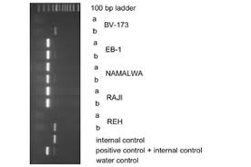 Such cells lines are called established cell lines primary cell lines secondary cell lines propagated cell lines answer : German Collection Of Microorganisms And Cell Cultures Gmbh Virus Testing