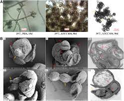 Abstract fonsecaea pedrosoi is a fungal pathogen that produces melanin. Muriform Cells Can Reproduce By Dividing In An Athymic Murine Model Of Chromoblastomycosis Due To Fonsecaea Pedrosoi In The American Journal Of Tropical Medicine And Hygiene Volume 103 Issue 2 2020