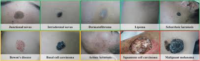 In fact, skin cancer is the second most common cancer in cats. The Sample Of 10 Types Of Skin Tumors In Our Dataset The Images With Download Scientific Diagram