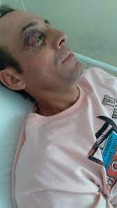 Un Hombre Denuncio Que Fue Golpeado Por Policias Canal Verte