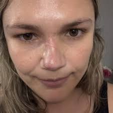 C WILLIAM HANKE, MD, FACP