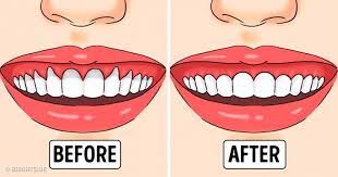 If You Have Receding Or Unhealthy Gums Here Are Proven Solutions Swollen Gum Causes Of Bad Breath Healthy Teeth