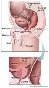 While i understand no man wants ed, a biopsy is the only way to confirm if you have prostate cancer or not. Prostate Specific Antigen Testing Overview Physiologic Characteristics Of Psa Other Prostate Cancer Markers