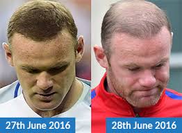 The hair building fibers cling to your existing hair by way of static electricity. Is Wayne Rooney Using Hair Loss Concealers