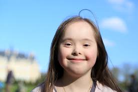 Down syndrome (trisomy 21) is a genetic disorder. Down Syndrom Trisomie 21 Ursachen Beschwerden Therapie Gesundpedia De