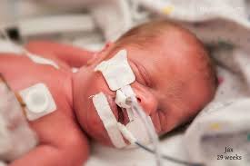Premature Birth Facts And Statistics