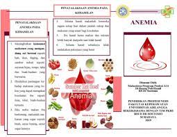 Maybe you would like to learn more about one of these? Doc Leaflet Anemia Kehamilan Docx Yeni Rahayu Academia Edu