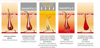Can come per la luce pulsata anche molti dei lazer utilizzati hanno efficacia sui peli in fase anagen di crescita, per cui è necessario radere el area da trattare prima pada sottoporsi al laser through modo da pareggiare chicago crescita dei peli. Gli Epilatori A Luce Pulsata Piu Venduti Del Momento La Soluzione Definitiva Anche A Casa Qualita Prezzo It