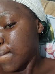 so guys what can i use to make my skin be white and smooth plz