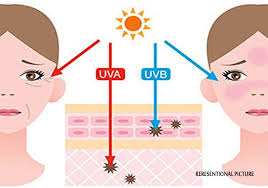 Uvb is responsible for the majority of sunburns. How Sun Gives You Wrinkles Skin Cancer India Tv News Lifestyle News India Tv