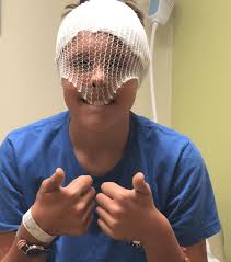 The Struggle is Real: On Black Bear Bites + Best Case Scenarios