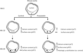 The noblewoman was feng rushuangs auntliu yus biological mother, mei ying. Statin Effects On Vascular Calcification Arteriosclerosis Thrombosis And Vascular Biology