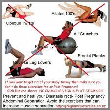Will my diastasis recti heal on its own? How To Prevent Diastasis Recti During Pregnancy Pregnancy