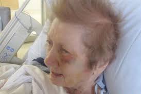 Brick Case Inspires Bill to Protect Elderly Patients