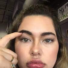 Before and after pictures are a great place to start. Am I A Good Candidate For A Botox Brow Lift Photos