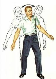 Image result for Ataxia