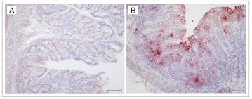 Toxins Free Full Text Toll Like Receptor 4 Signaling In The Ileum And Colon Of Gnotobiotic Piglets Infected With Salmonella Typhimurium Or Its Isogenic Rfa Mutants Html