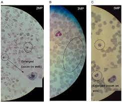 The data we will use in our project consists of cell images under the microscope. Pictures From Malaria Parasites Stained With A Regular Giemsa Stain And Download Scientific Diagram