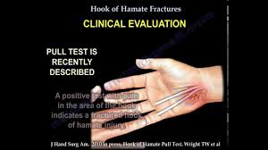 Image result for Hamate Bone