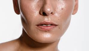 顔のテカリ・オイリー肌がひどい！テカリの原因と抑える方法を美容皮膚科医が解説！ | 恵比寿駅徒歩1分の美容皮膚科 | ATELIER Medical  Clinic（アトリエメディカルクリニック）