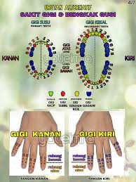 Sedangkan fluoride ini adalah kandungan mineral yang ini dia 3 cara atasi sakit gigi berlubang secara alami! Rupa Rupanya Boleh Rawat Sakit Gigi Guna 2 Bahan Guna Teknik Urut Alternatif