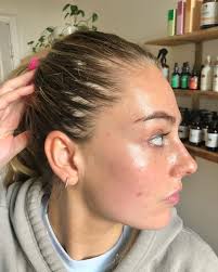 Call me the 🐐🧚🏼‍♀️ ! Swipe for incredible transformation + video  content. Thank y'all for trusting me with your precious skins.  #integrativeesthetican #skinhack #skinhealth #skinrituals #ritualbodystudio  #holisticesthetician #integrativeacne ...