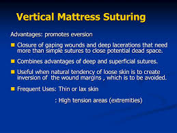 We did not find results for: Ppt Suturing Is Fun Powerpoint Presentation Free Download Id 277971