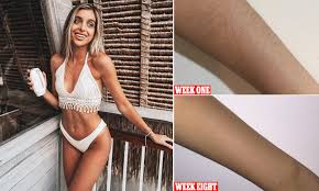 A short course of ipl (intense pulsed light) can replace the need treatments with the ipl machines in our perth clinic is very fast. Beauty Experts Weigh In On Whether Diy Laser Hair Removal Really Works Daily Mail Online