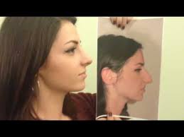 Rinoplastica Roberto Medical Group