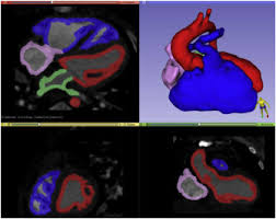 Review crime maps, check out nearby restaurants and amenities, and read. 4 Dimensional Virtual Reality Cine Cardiac Model Using Free Open Source Software Journal Of Cardiovascular Computed Tomography