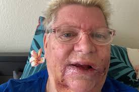 Fundraiser by Roger White : The Bite of 2021- The Great Anatolian Scare