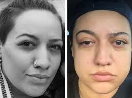 Fundraiser for stephanie rodriguez by Shaymari Musiq : Stephanie's Graves  Surgery