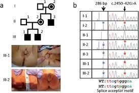 As such, the insensitivity to androgens is only clinically significant when it occurs in individuals with a y chromosome or, more specifically, an sry gene. Partial Androgen Insensitivity Syndrome Caused By A Deep Intronic Mutation Creating An Alternative Splice Acceptor Site Of The Ar Gene Scientific Reports