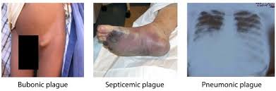 Bueno la parte cuatro de la guia de penumbra black plague espero les guste y no olviden que el próximo 4, 5 y 6 de noviembre sera la convención de juegos de. Symptoms Plague Cdc